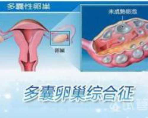 做试管婴儿之前需要减肥吗？~代怀助孕套餐