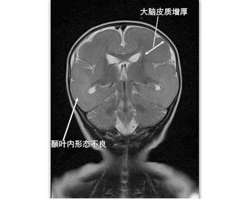2026江西人如何申请享受国家免费孕前检查优惠政策?